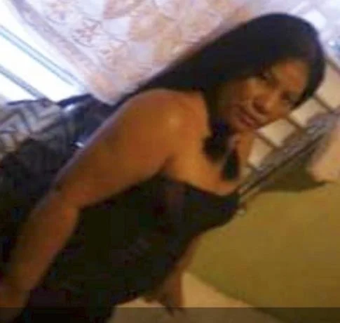 Miladys: “Era pequeñita, pero me dejó un hoyo y una herida larga”