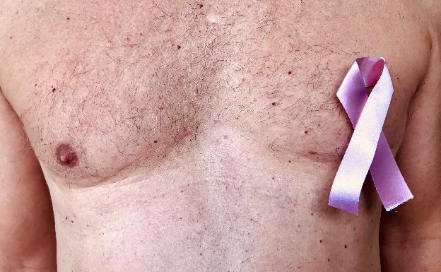 Advierten cáncer de mama puede afectar también a los hombres