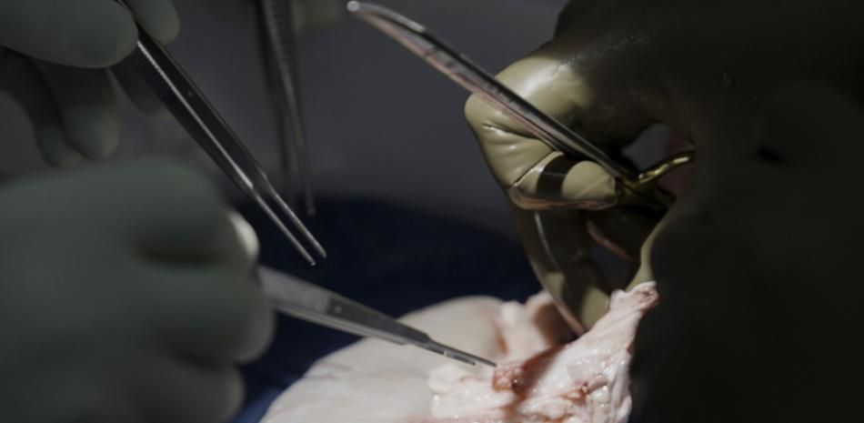 Los trasplantes de riñón de cerdo más cerca: logran una supervivencia de dos años