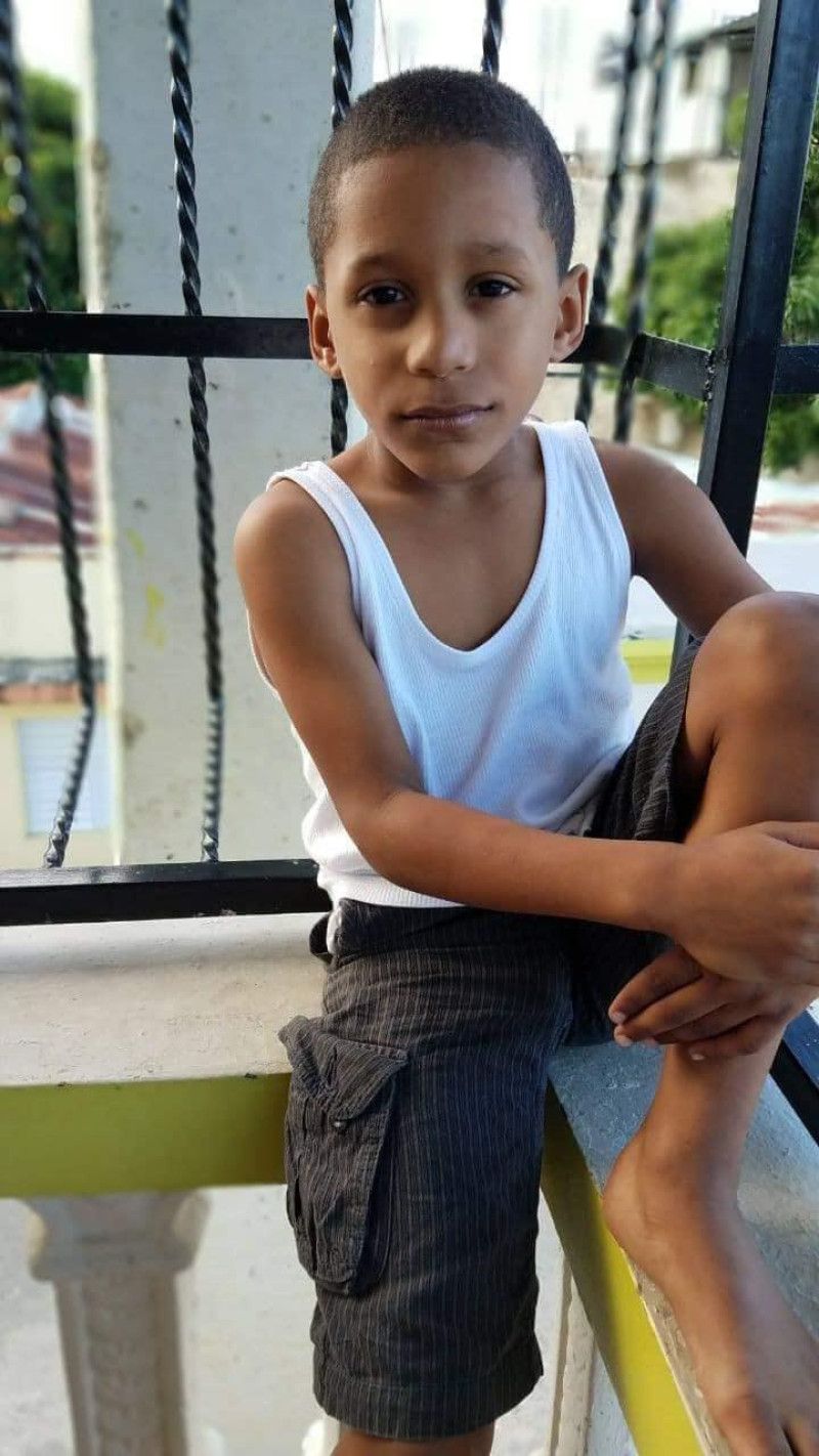 Muere menor que estaba ingresado en hospital de Santiago tras incendio en carnaval de Salcedo