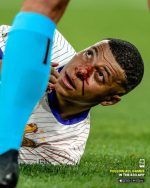 Kylian Mbappé sale con golpe en la nariz y Francia derrota 1-0 a Austria en la Eurocopa