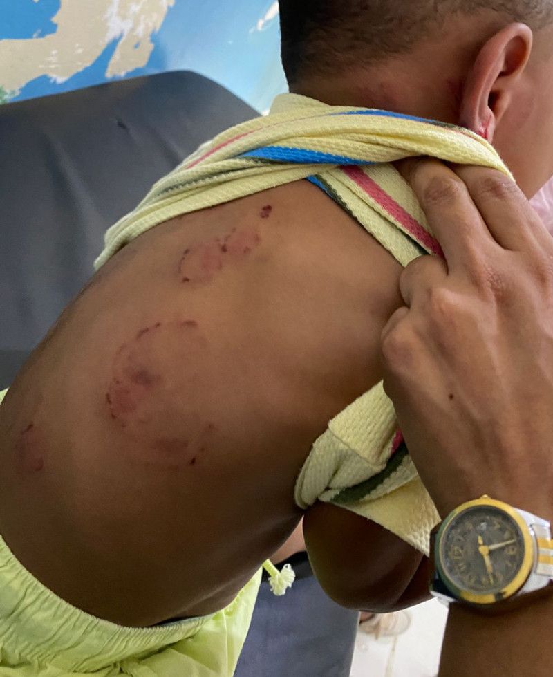 Inaipi despide personal por agresión a niño en Caipi de Santiago