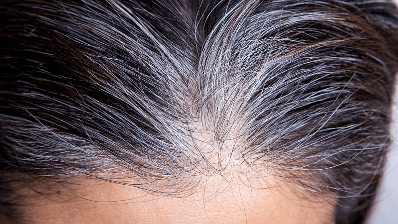 ¿Sabes por qué a la gente joven le salen canas?