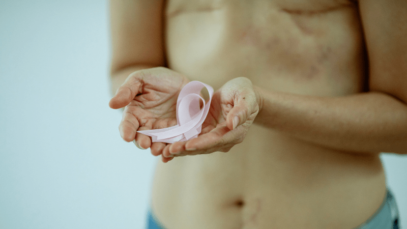 En un año, más de 11 mil personas fueron diagnosticadas con cáncer de mama en RD