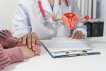 Más de la mitad de los casos de cáncer de ovario se detecta en etapa avanzada