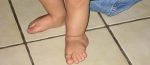 Someten a un niño a una cirugía pionera