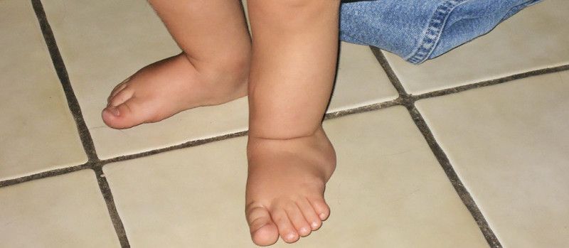 Someten a un niño a una cirugía pionera