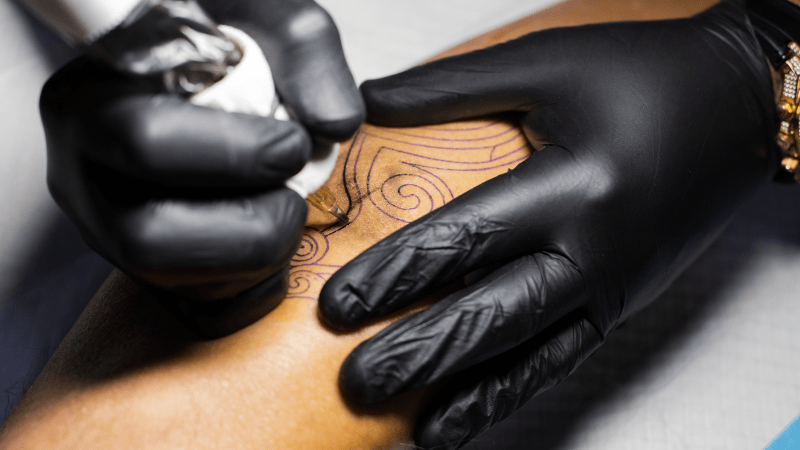 La radioterapia guiada por superficie permite evitar los tatuajes permanentes en pacientes de cáncer