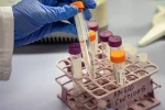 Científicos desarrollan terapia génica para prevenir el alzhéimer