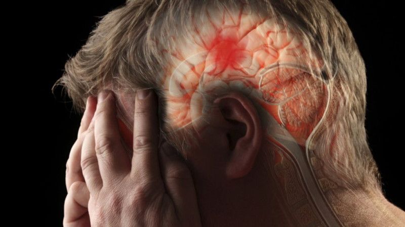 Sociedad de Neurología pide al país mayor respuesta frente a los ACV